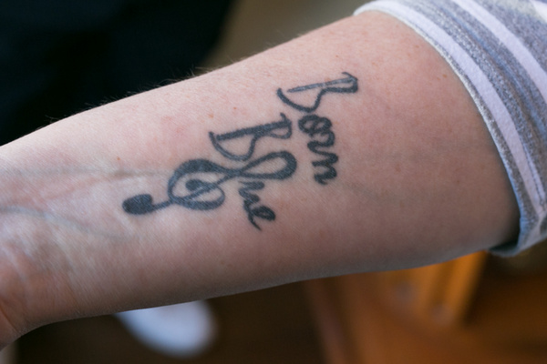 Karen Lovely's arm
